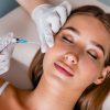 Bellafill semi-permanent filler 9 Bellafill Filler