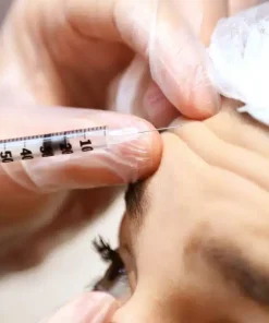Bellafill Filler