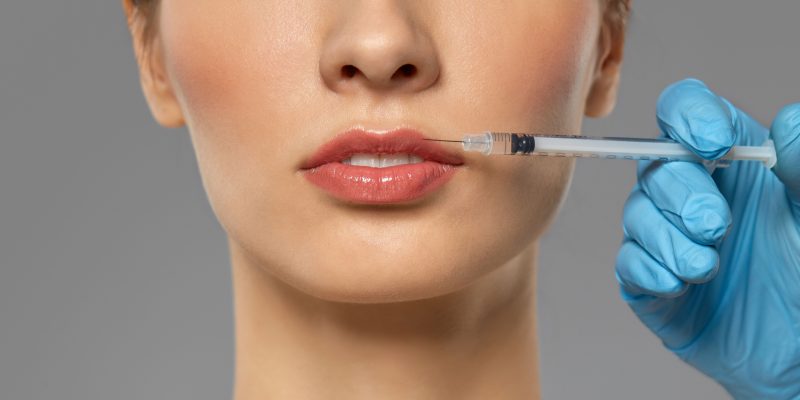 Juvederm fillers near me 12 juvederm lip filler