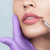 Juvederm fillers near me 8 juvederm near me