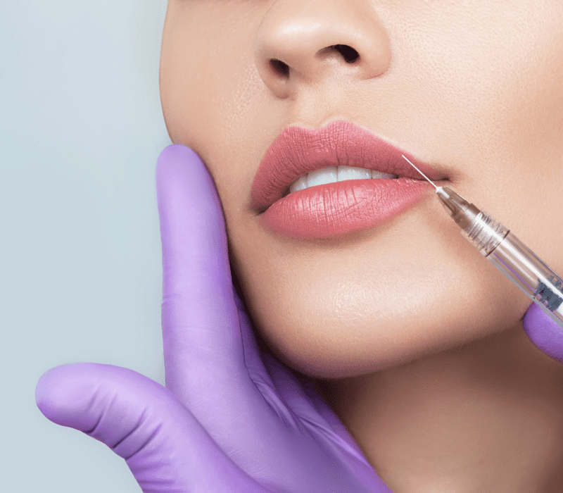 Juvederm fillers near me 1 juvederm near me