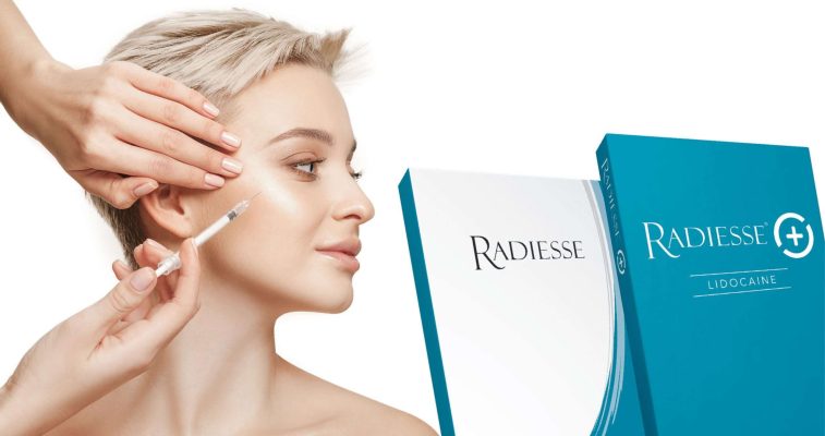 Radiesse filler
