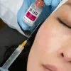 sculptra buttocks injections