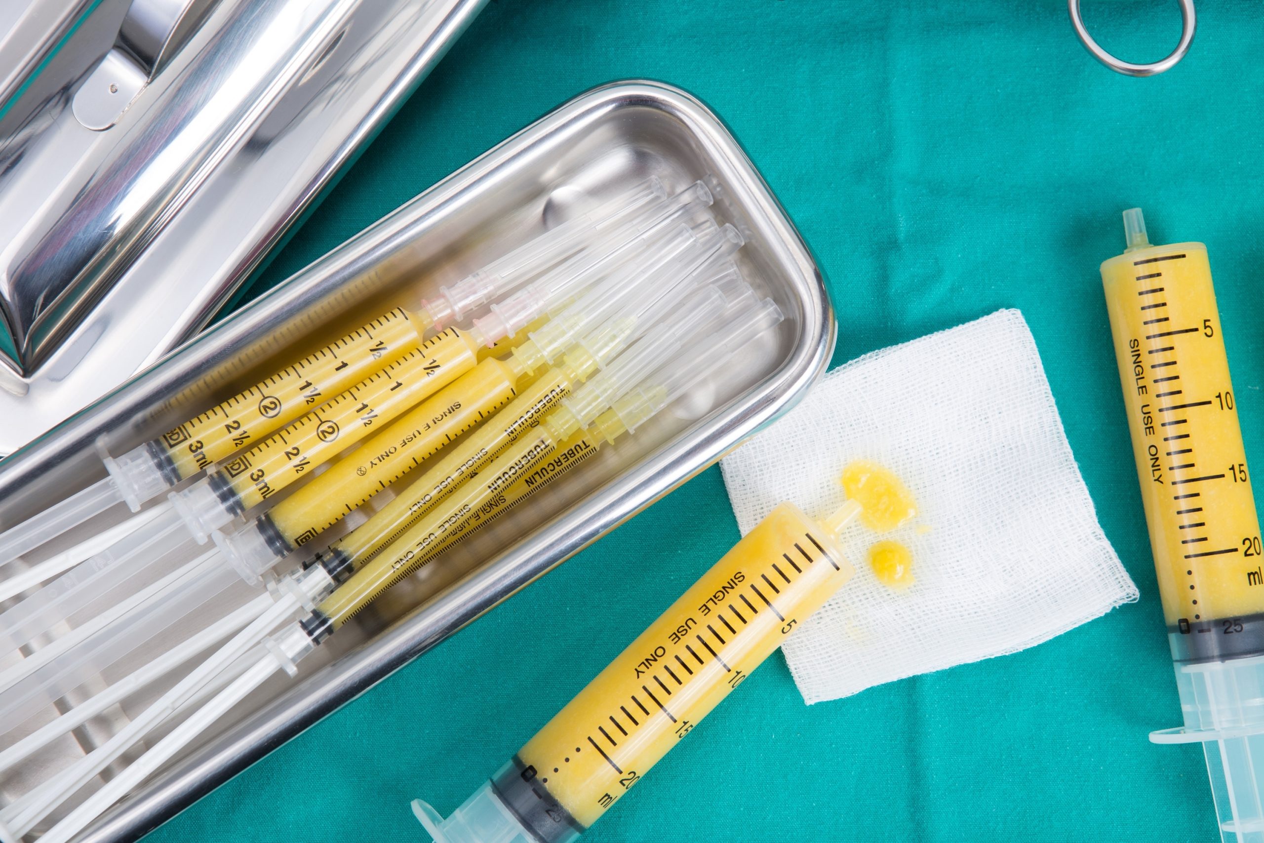 fat grafting breast and face 3 fat grafting