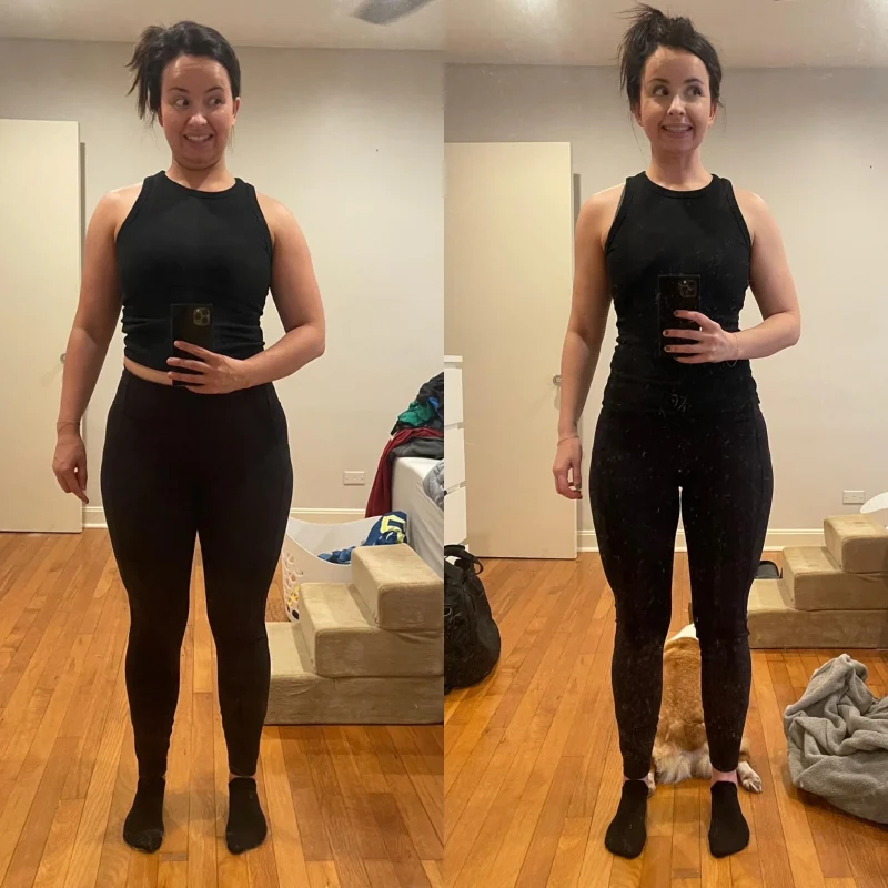 What Are Biostimulator Injections? 3 The rise of GLP-1 medications, including victoza weight loss protocols, has created new opportunities in aesthetic medicine.